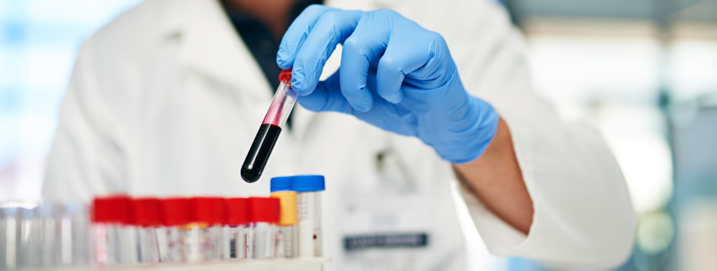 Esami del Sangue