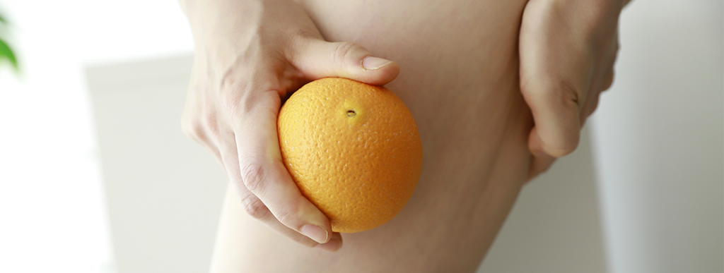 Cellulite cause e rimedi contro la pelle a buccia d’arancia