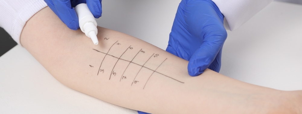 allergologia bologna