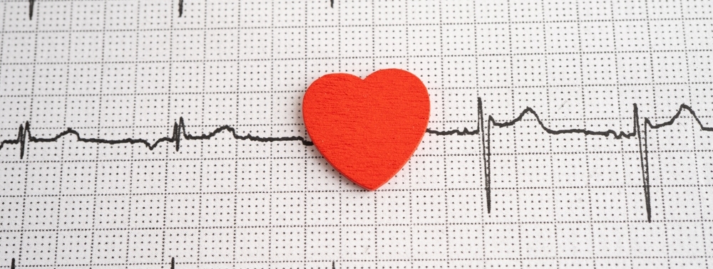 elettrocardiogramma bologna dyadea