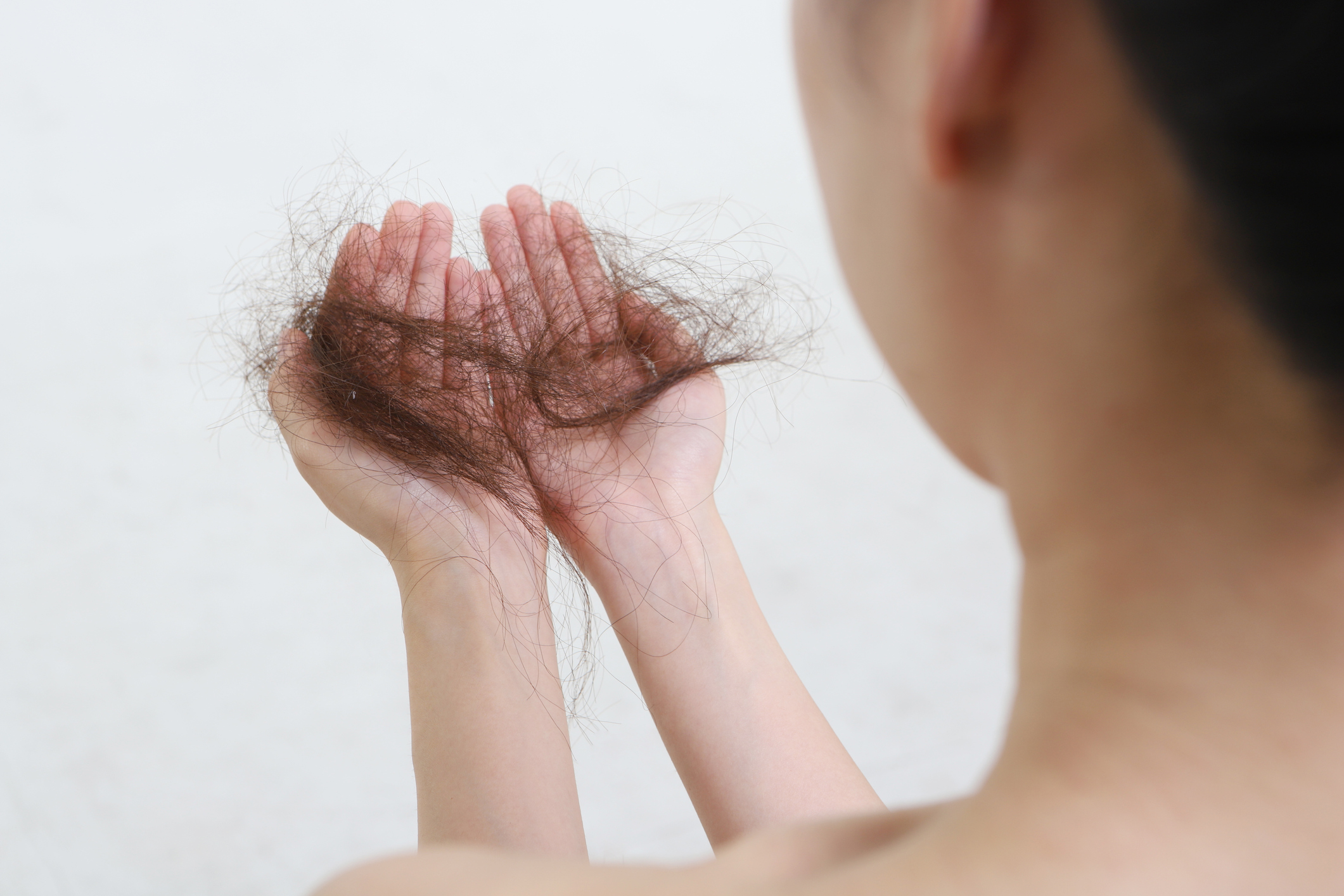 20220801_Alopecia.jpg